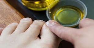 Aceites esenciales para combatir el hongo